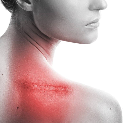 Red Light Therapy For Scars