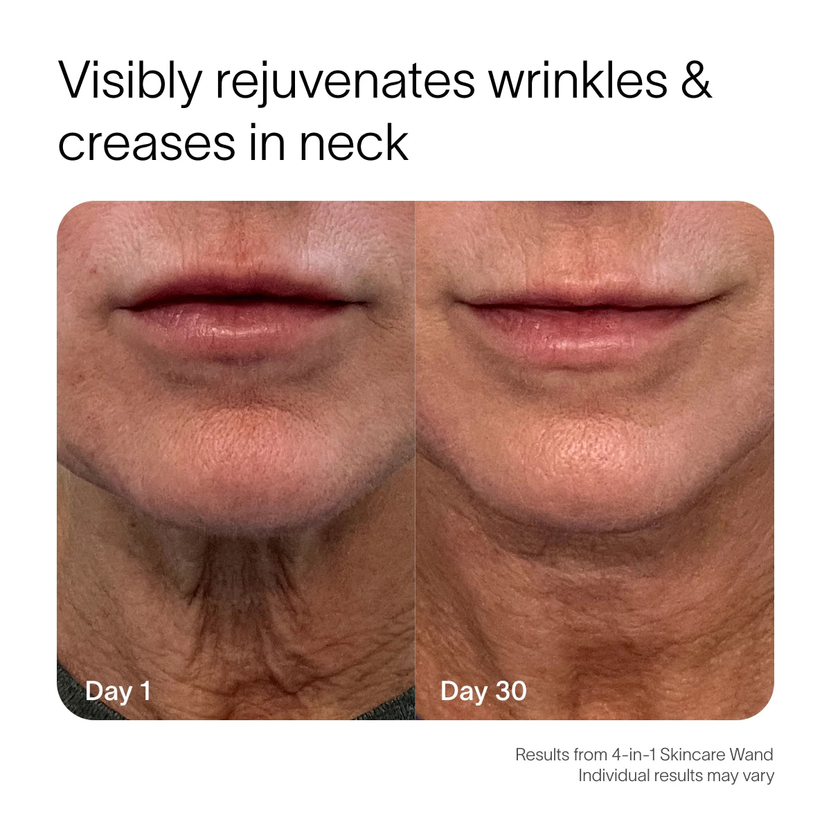 The Solawave 4-in-1 Red Light Therapy Wand & Activating Serum Kit shows side-by-side neck and lower face images labeled Day 1 and Day 30. The Day 30 image reveals smoother, younger-looking skin, highlighting reduced wrinkles. Text reads: Visibly rejuvenates creases. Results may vary. || Rose Gold