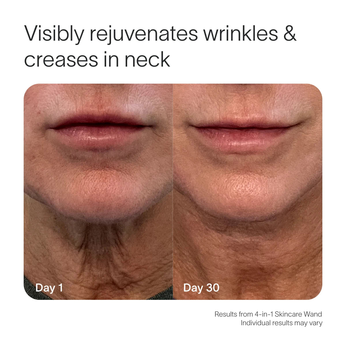 The 4-in-1 Skincare Wand & 3-Month Serum Kit by Solawave shows a side-by-side comparison of neck and mouth improvements from Day 1 to Day 30. Text reads: Visibly rejuvenates wrinkles & creases in neck, with a disclaimer about individual results.