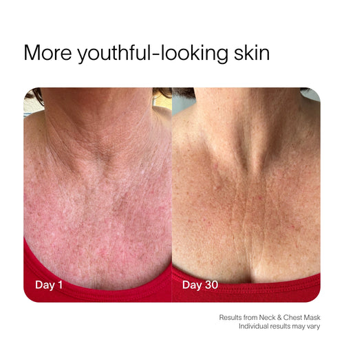 Comparison of Day 1 and Day 30 neck skin shows improved texture and appearance, featuring a person in a red top. Text reads More youthful-looking skin with Solawaves Neck & Chest LED Mask w/ LightBoost Cream Kit; individual results may vary.