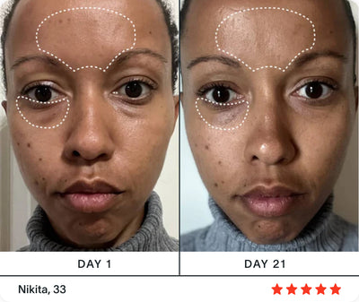 face red light therapy before and after